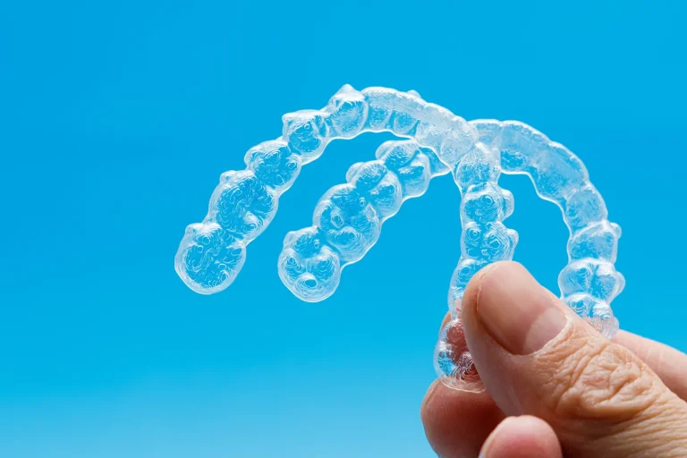 Invisalign koszt